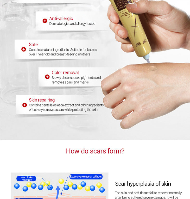 Light Scar Cream Scar Fine Grain Desalination Skin Care Products