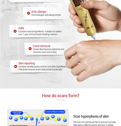 Light Scar Cream Scar Fine Grain Desalination Skin Care Products